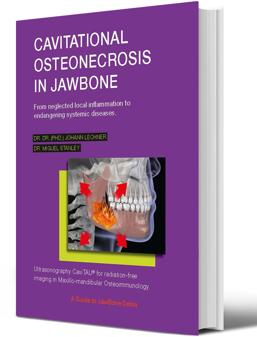 Volume I - IV (English) "Cavitational Osteonecrosis in Jawbone".