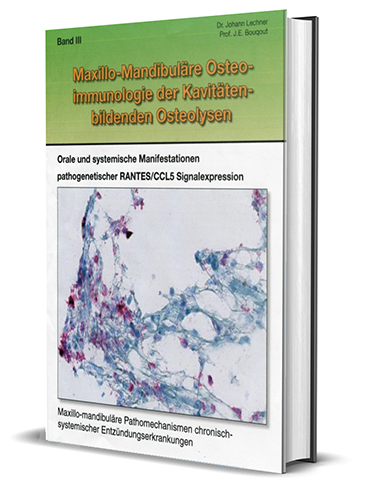 Volume III (german): Cavity forming osteolysis of the jawbone